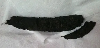 똥이 까만색 검정똥 원인과 질병 가능성_7