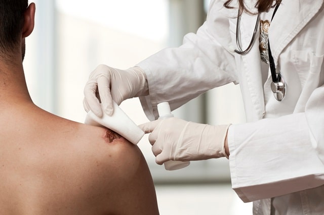 일본 전염병 STSS