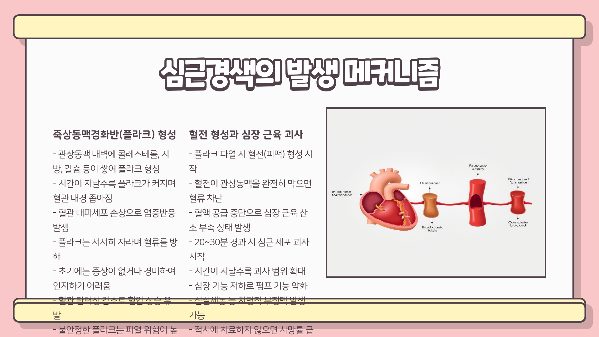 심근경색이란? 심근경색 전조증상 &amp;#124; 심근경색 초기증상 &amp;#124; 심근경색 원인 총정