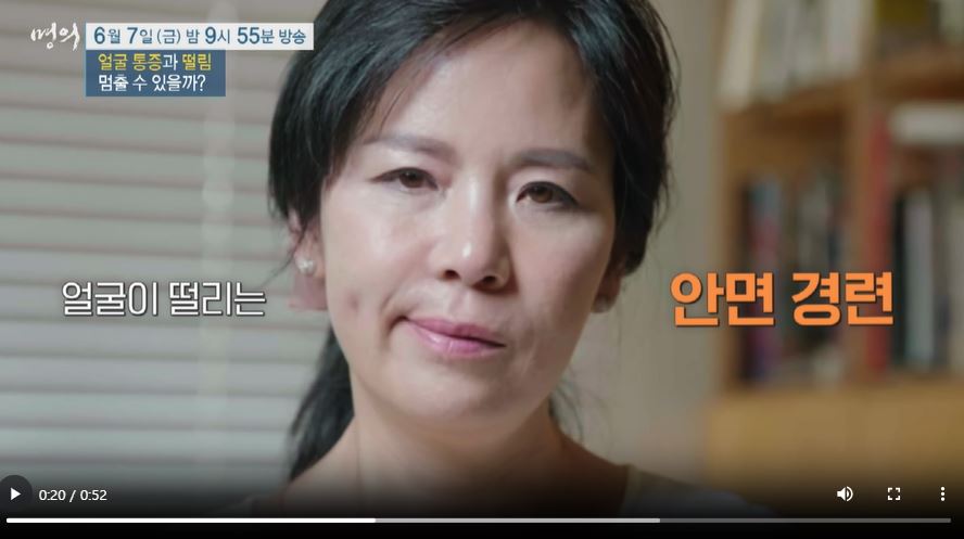 EBS 명의 삼차신경통 원인 증상 치료