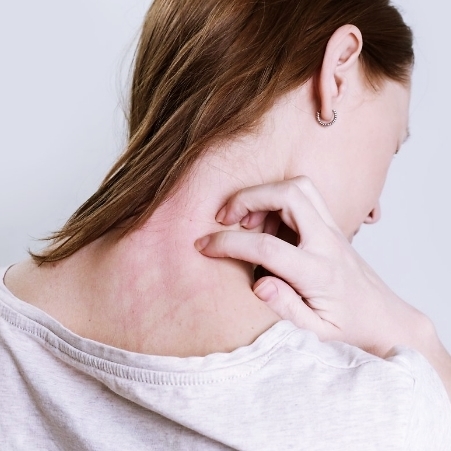 면역력이 떨어졌을때 증상