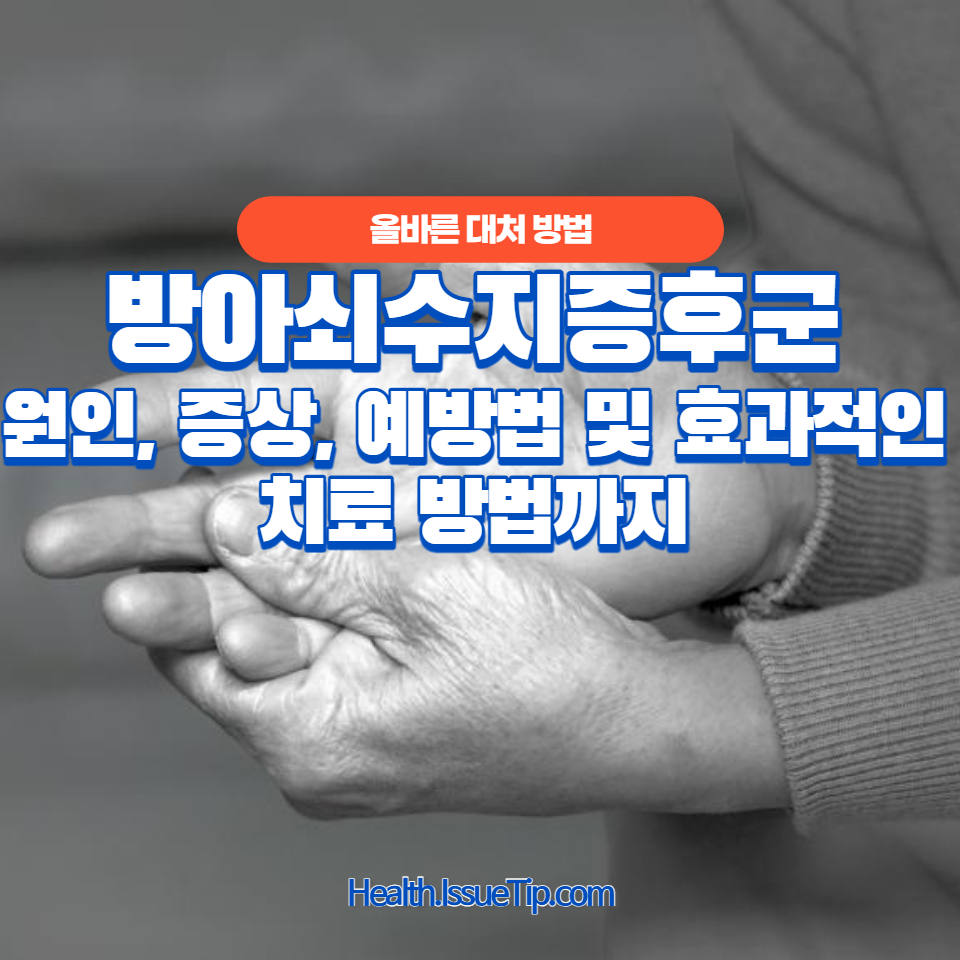 방아쇠수지증후군에 대한 모든 것