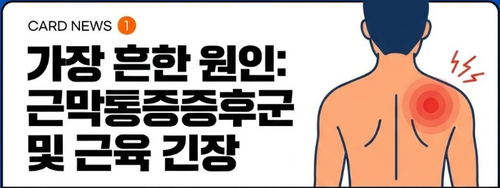 근막통증증후군 및 근육 긴장