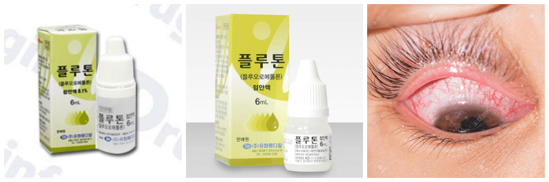 플루톤점안액, 안검염 사진
