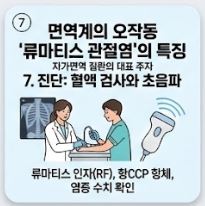 류마티스 관절염 초기증상