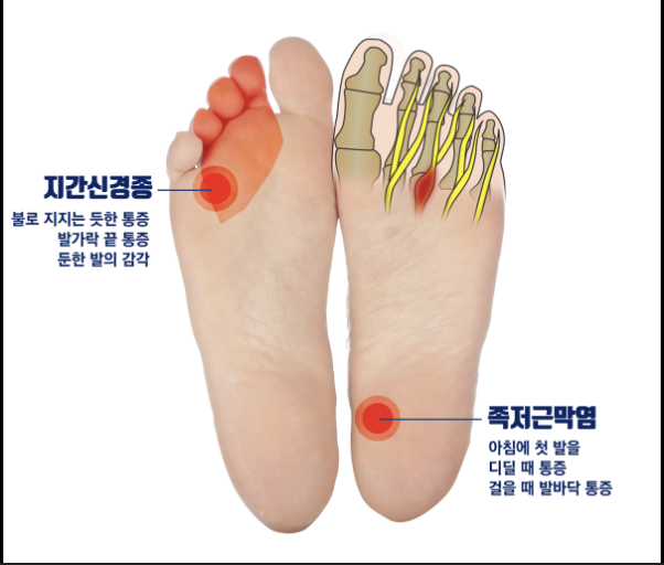 족부신경종(2)