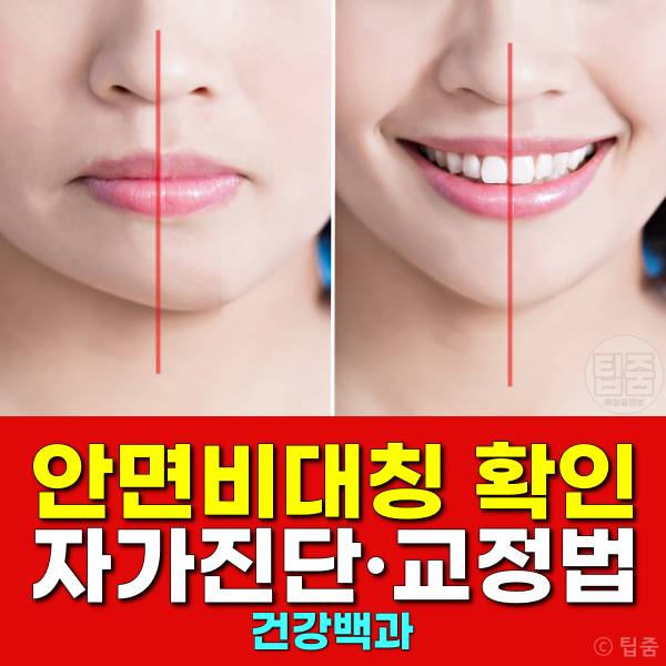 안면비대칭 확인 교정