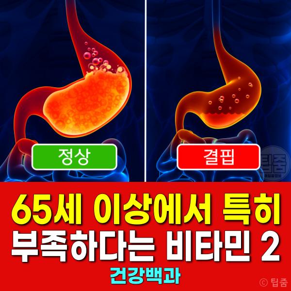 65세 시니어영양제 노인영양제 추천