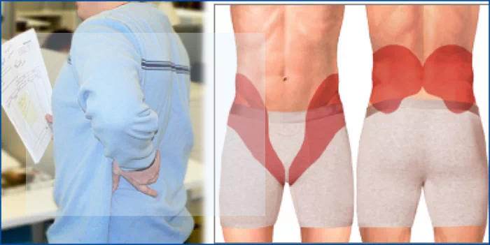 요로결석 통증 부위