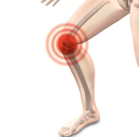 쇠비름 효능