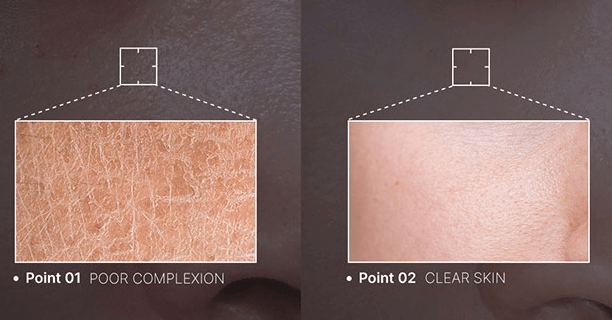 홈 뷰티 디바이스