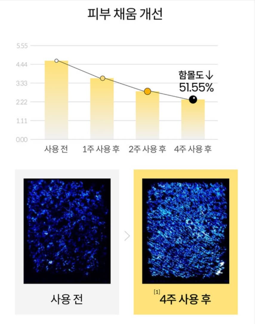 피부채움개선
