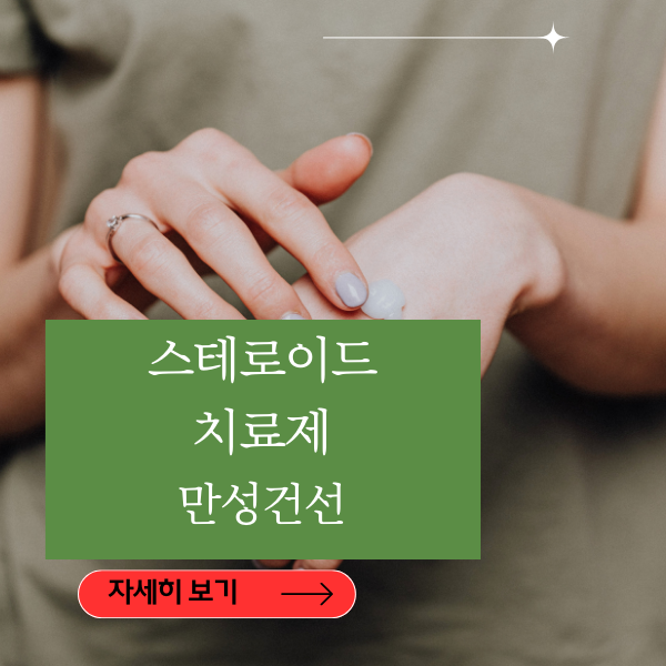 건선의 초기증상,스테로이드제