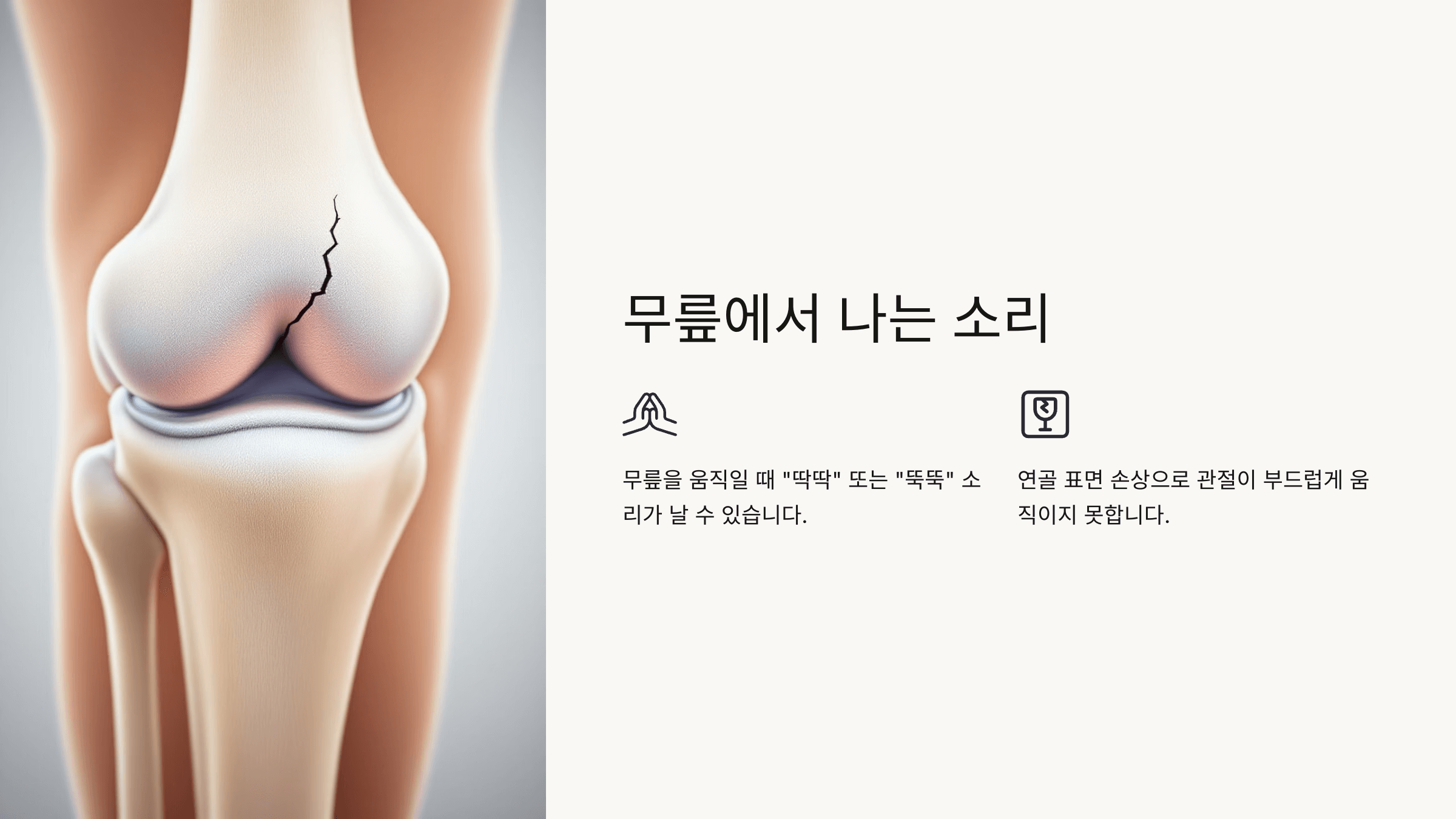 무릎 연골과 관련된 사진입니다.