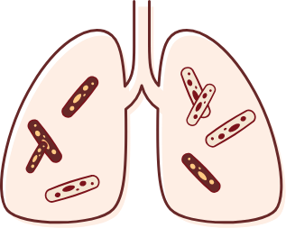 결핵 증상&middot;원인&middot;치료 - 감기와 혼동하기 쉬운 결핵