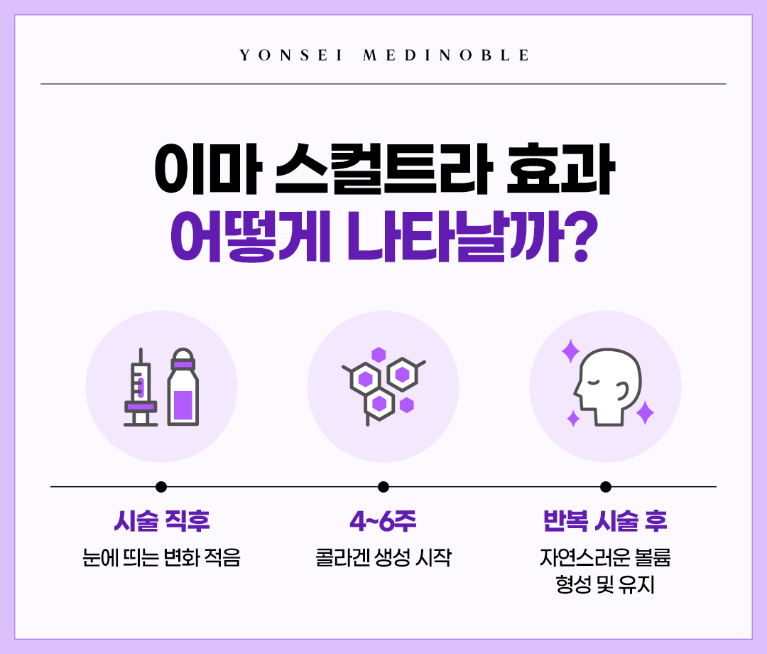 이마 스컬트라 효과 변화 과정 타임라인