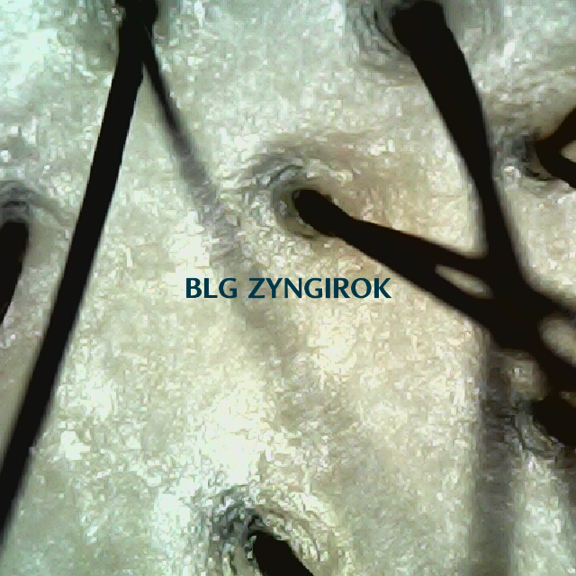 탈모 극복 프로젝트 - 정수리 두피 모습이다.