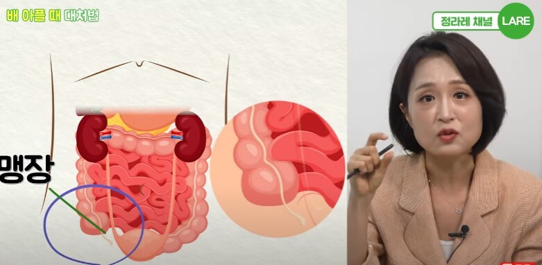 배아플때 대처법, 복부 위치에 따라 통증이 다릅니다.