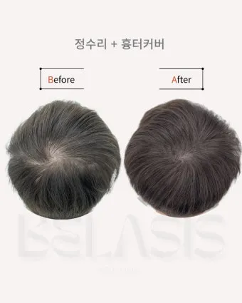 정수리가 아픈 이유와 완화하는 방법_24