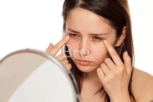 다크써클 보고 놀라는 사진 2