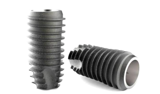 임플란트 지원금