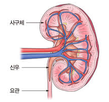 사구체병증