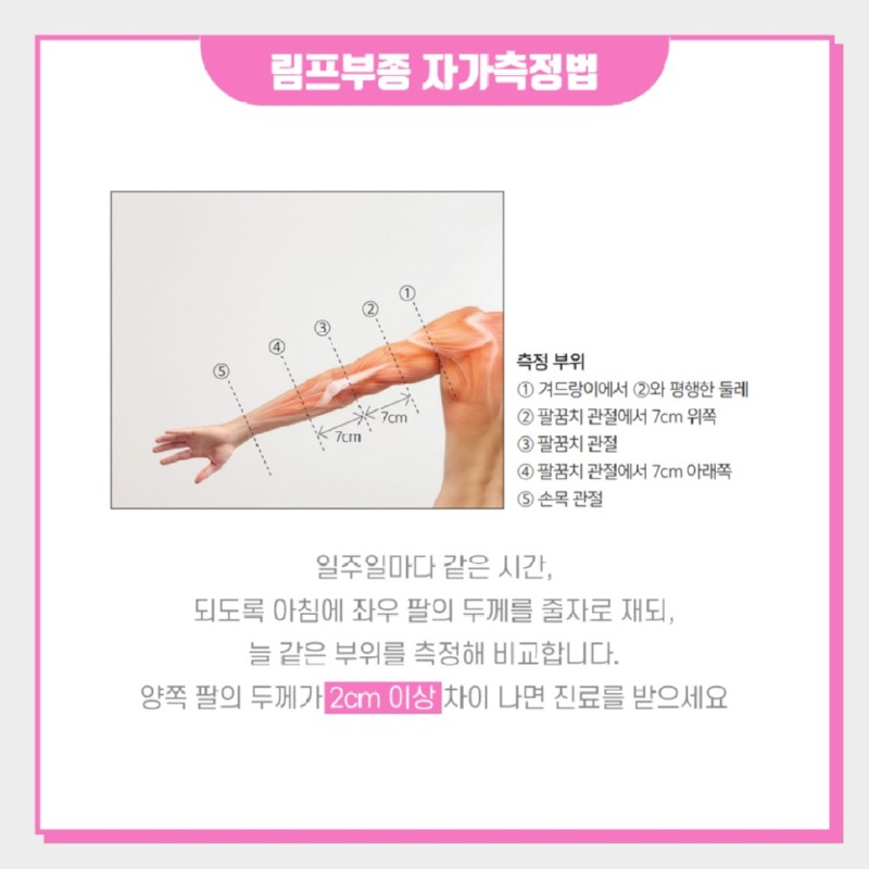 림프부종 자가측정 법 사진 예시