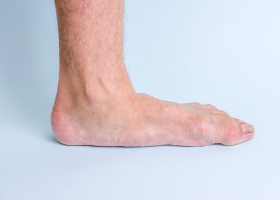 평발(Flat Feet) – 원인, 증상, 관리법 총정리