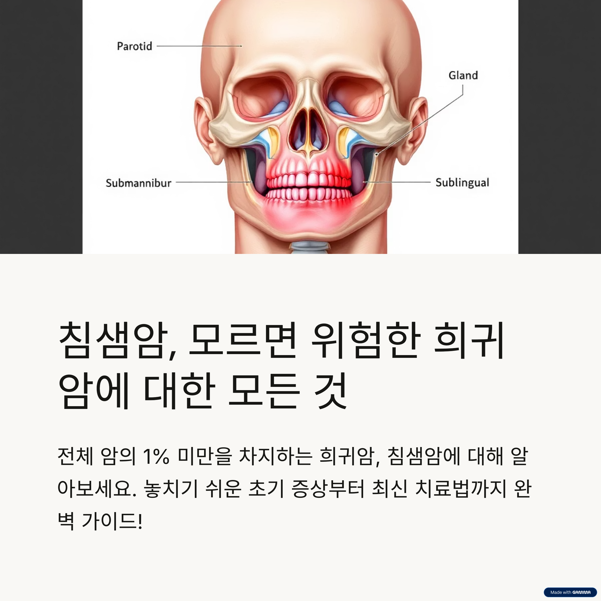 침샘암 증상, 원인, 치료법 총정리 (뮤코표피암 포함)