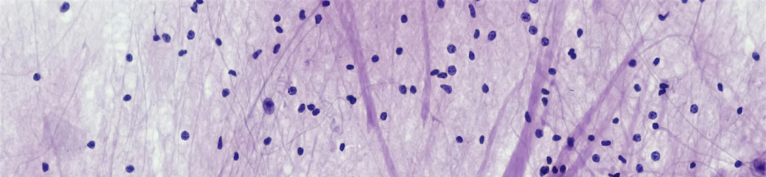 포스파티딜-세린-효능-기억력영양제-집중력개선-부모님건강-뇌영양제