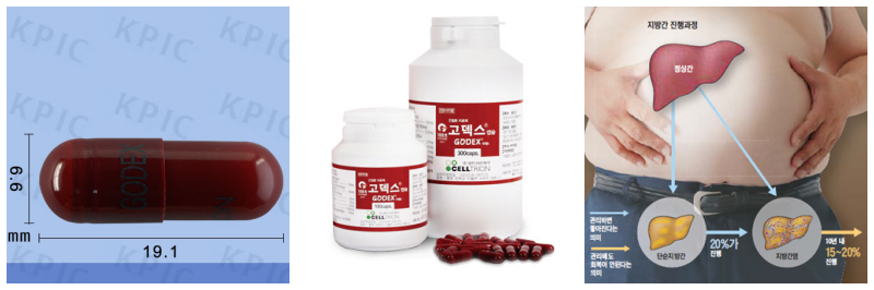 고덱스캡슐, 지방간 사진