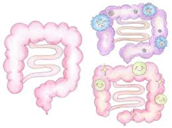 방귀가 많이 나오는 이유