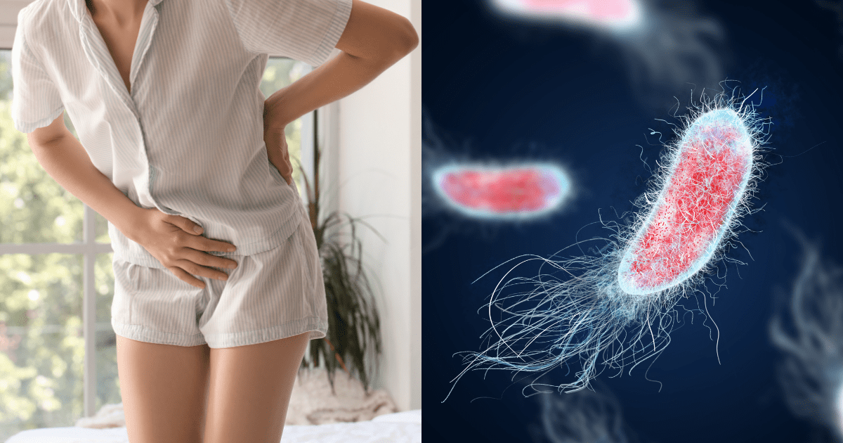 방광염으로 배를 움켜쥐는 여성과 미생물 바이러스