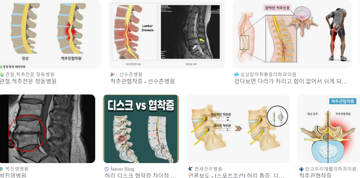 허리 협착증에 좋은 운동 26