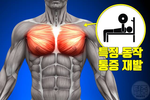 운동 가슴통증 원인 운동후 가슴통증 흉통 근육통