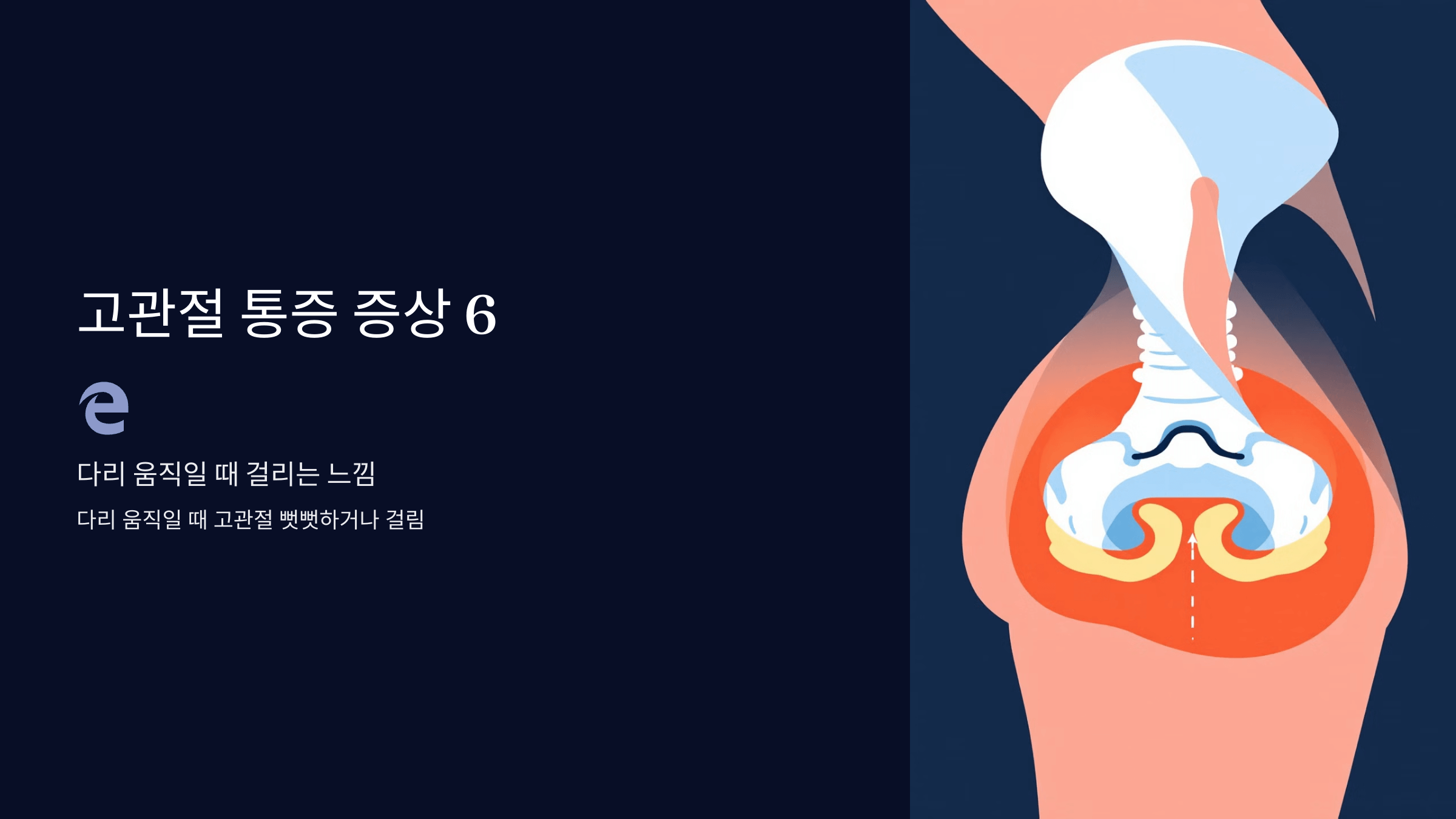 고관절 통증과 관련된 사진입니다.