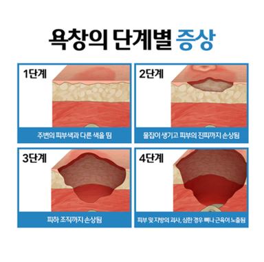 욕창-단계별-증상