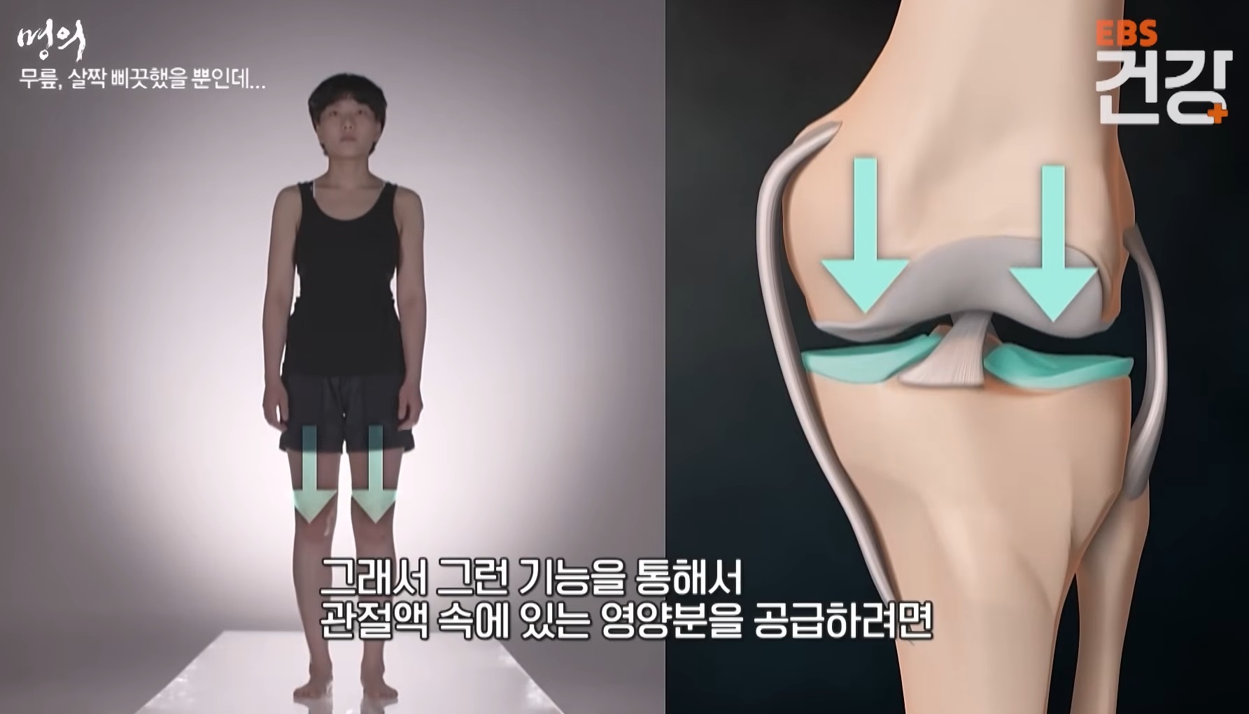 EBS명의-무릎-김성환-교수