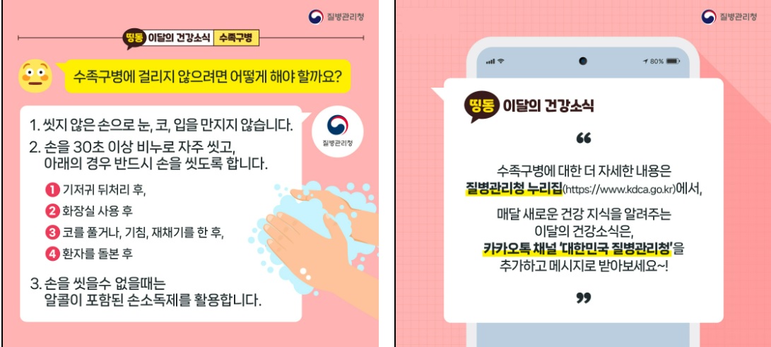 수족구병