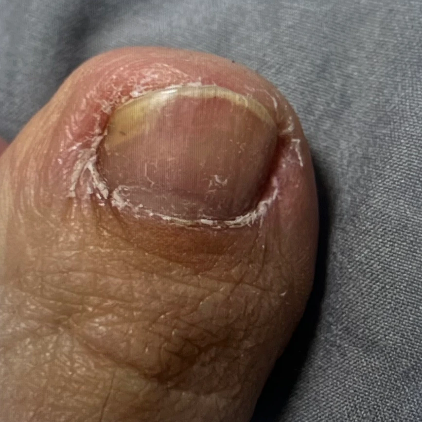 케라좀 큐어솔루션 후기 내돈내산 후기 증명사진