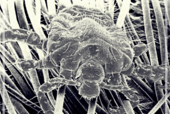 사면발이: 증상, 치료 방법, 그리고 전염성