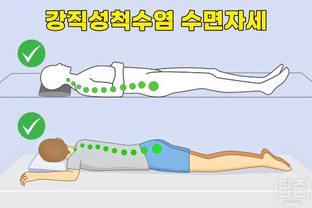 허리에 좋은 수면자세 나쁜자세 강직성척추염