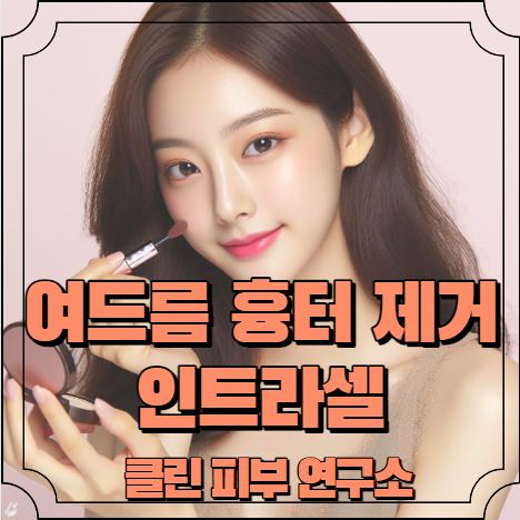 여드름 흉터 레이저 제거 인트라셀 알아보기