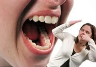입냄새 제거방법 증상 원인_22