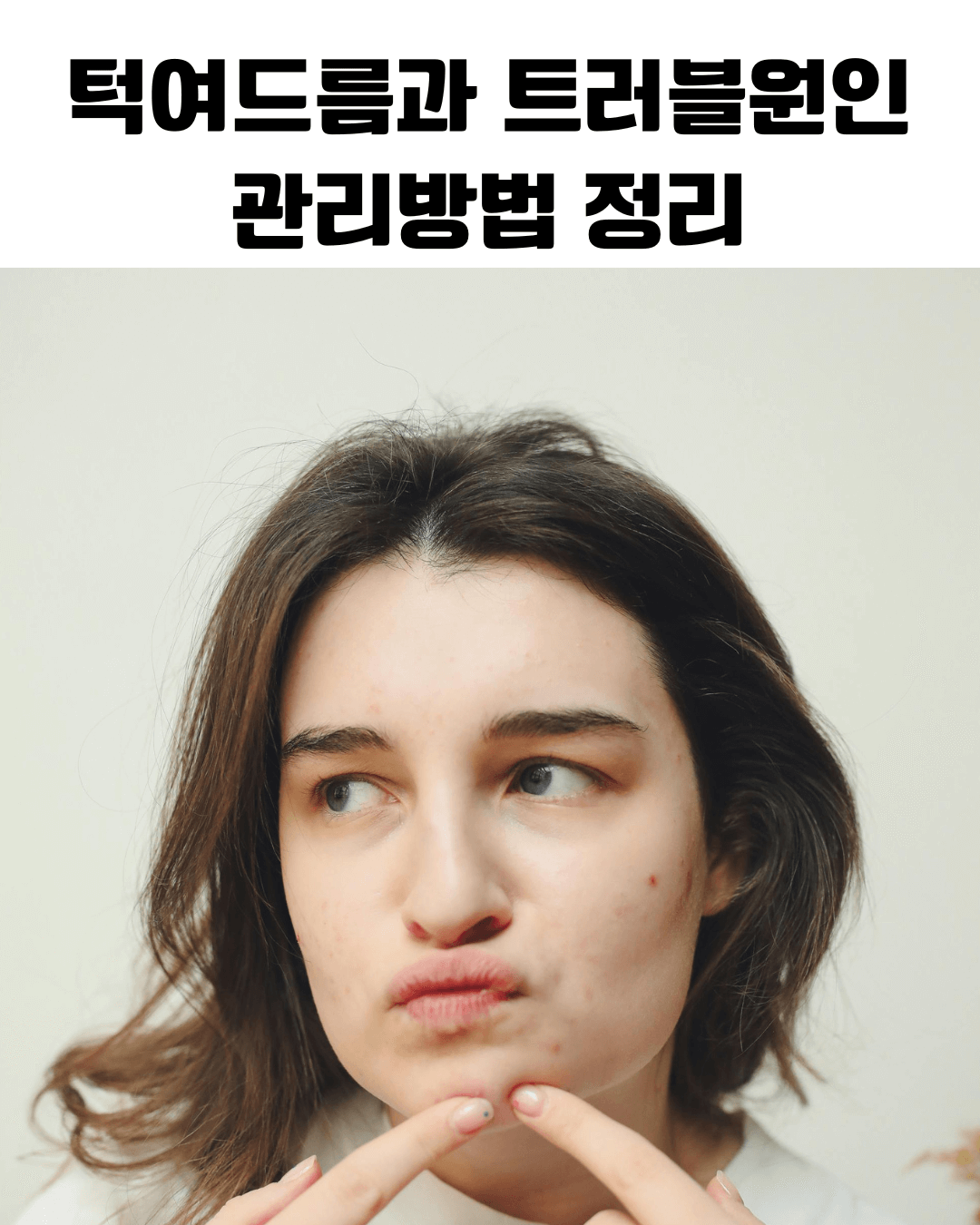 턱여드름 번지는 원인과 관리법 설명 이미지로 피지선 분포와 호르몬 영향에 따른 턱 트러블 발생 과정을 보여주는 피부 관리 정보 그래픽