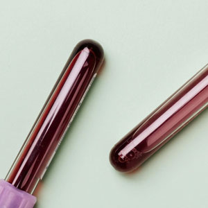 알부민 영양제 - 진짜 알부민인지 확인