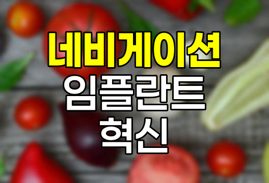 네비게이션 임플란트의 혁신과 한계