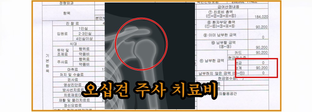 오십견-주시-치료비