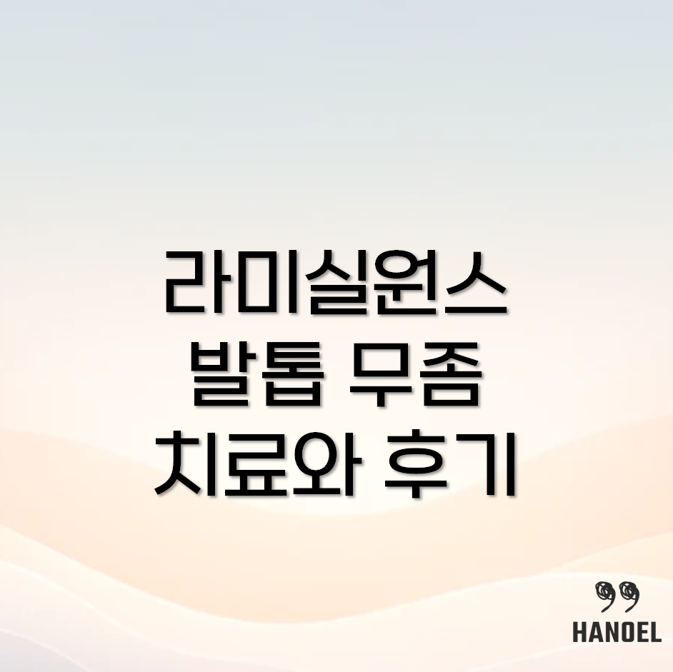 라미실원스 발톱 무좀 치료
