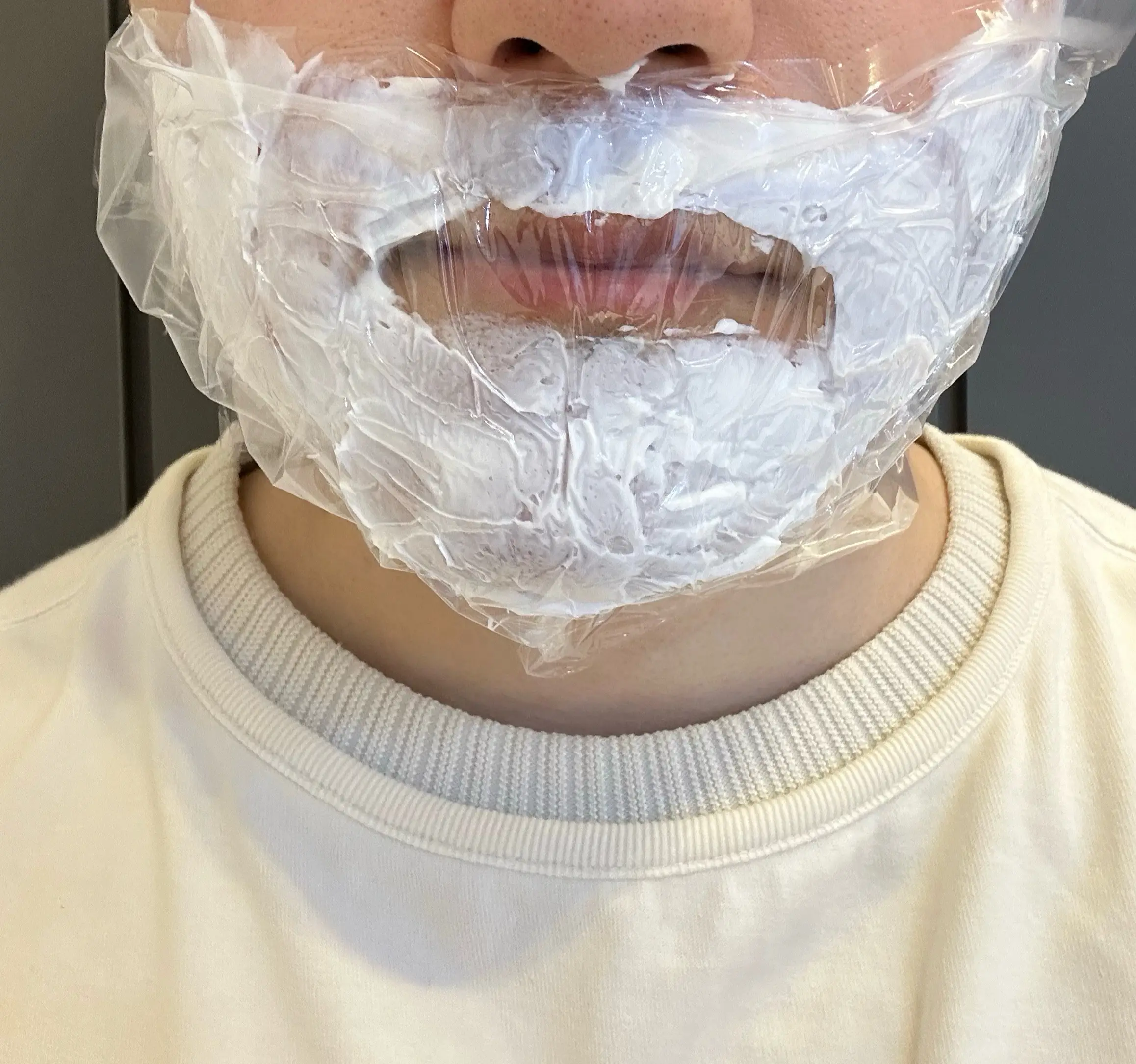 아포지-플러스-2회차-마취크림-바르고-대기